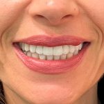 Clínica Dentária e Estética reabilitação oral Estética